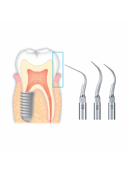 NSK INSERT ULTRASONIQUE G2