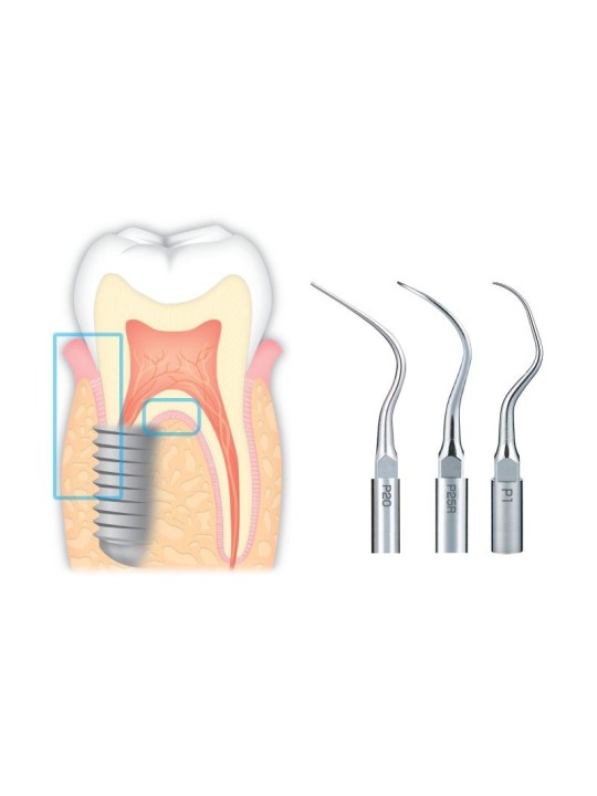 NSK PACK A INSERTS PARODONTIE