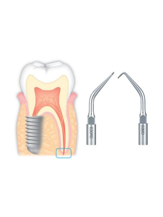 NSK PACK INSERTS ENDODONTIE RETROGRADE