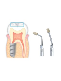 NSK KIT 10 CAPUCHONS INSERTS